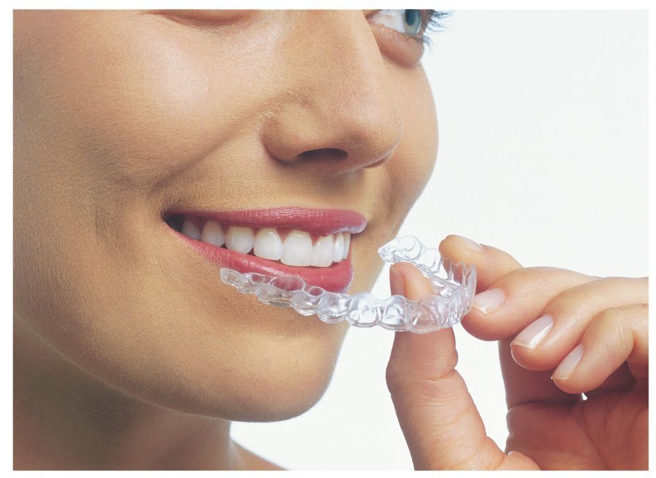 Photo courtesy of Invisalign. All Rights Reserved.